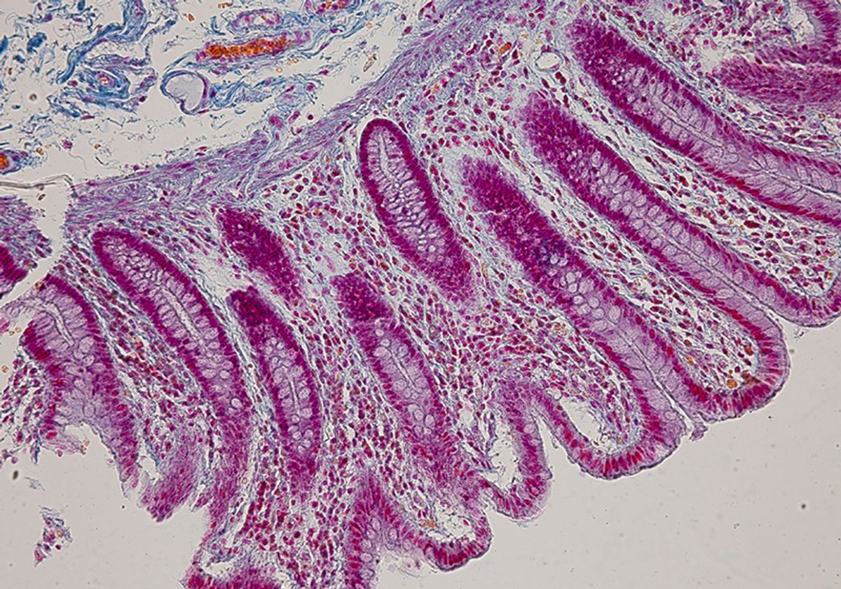 A microscopy image of intestinal crypts in human tissue.