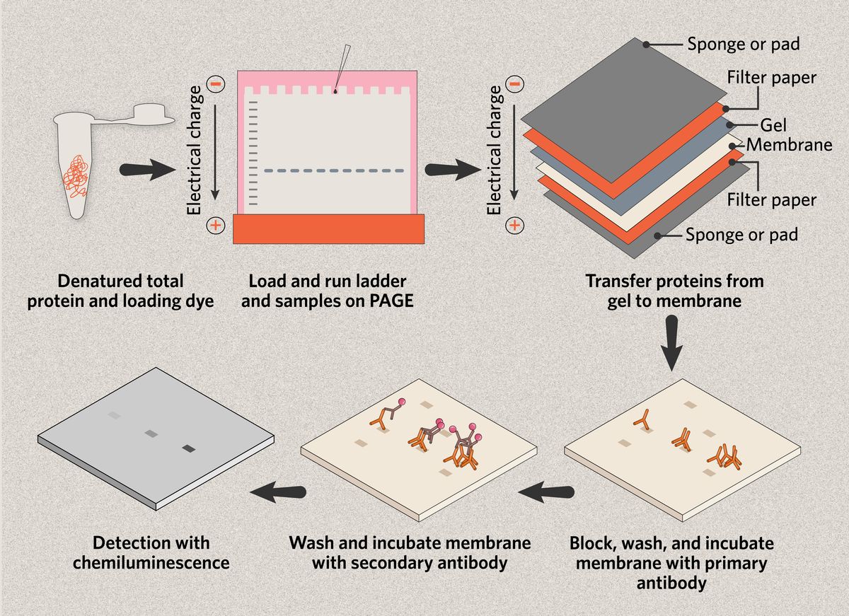 Steps in a typical western blot protocol: total protein is denatured and mixed with a loading dye; samples and molecular weight marker are loaded onto a polyacrylamide gel that separates the proteins using an electrical current and size-based matrix; proteins are transferred from gel to PVDF or nitrocellulose membrane by electrical charge; membranes are blocked, washed, and incubated with primary and secondary antibodies to detect specific target proteins; chemiluminescence or fluorescence detection allows protein visualization. Steps in a typical western blot protocol: total protein is denatured and mixed with a loading dye; samples and molecular weight marker are loaded onto a polyacrylamide gel that separates the proteins using an electrical current and size-based matrix; proteins are transferred from gel to PVDF or nitrocellulose membrane by electrical charge; membranes are blocked, washed, and incubated with primary and secondary antibodies to detect specific target proteins; chemiluminescence or fluorescence detection allows protein visualization.