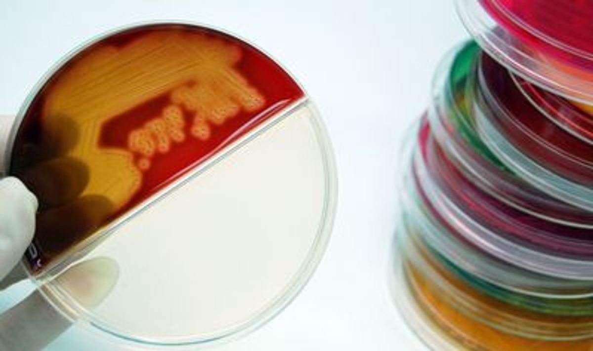 A researcher examines Petri dishes containing bacterial colonies growing in different types of culture media. A researcher examines Petri dishes containing bacterial colonies growing in different types of culture media.