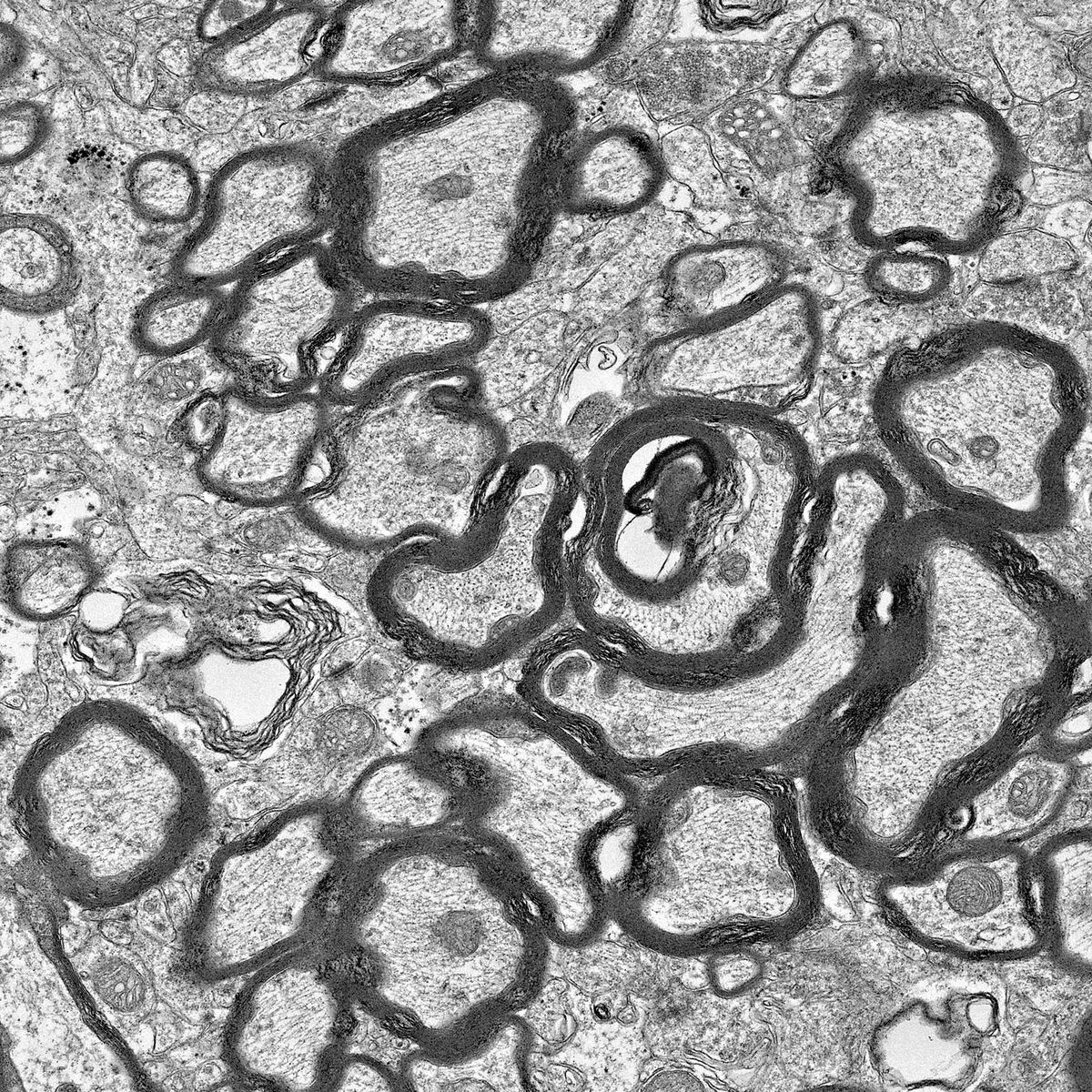 Dysregulated myelin in FIRE mice. Dysregulated myelin in FIRE mice.