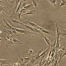 A microscopy image of several endometrial stromal fibroblasts
