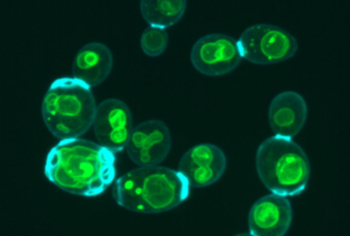 Fluorescent green circles inside larger circles with a blue edge. Fluorescent green circles inside larger circles with a blue edge.
