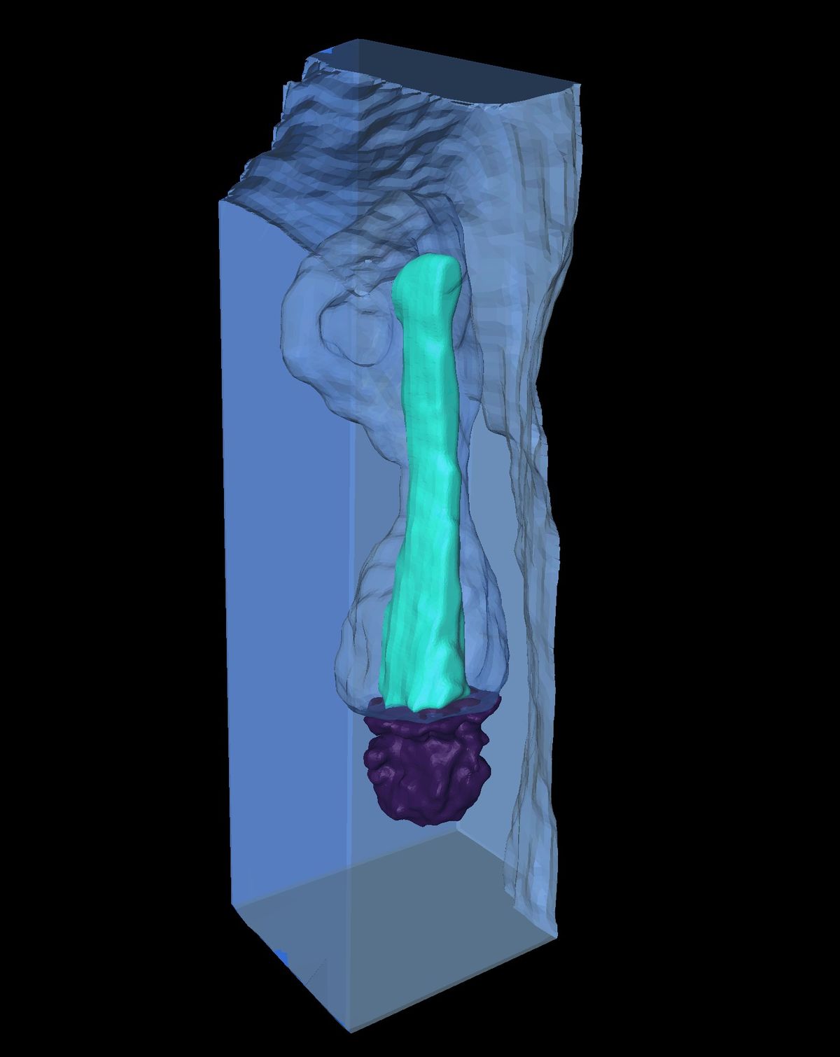 A 3D reconstructed image of a cyan primary cilium concealed within a clear membranous compartment and attached to a purple mother centriole. A 3D reconstructed image of a cyan primary cilium concealed within a clear membranous compartment and attached to a purple mother centriole.