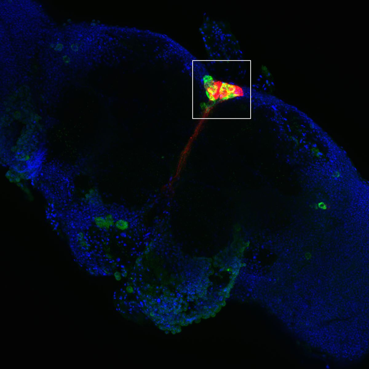An image of cells on a black background, with some cells stained red, some others green, and blue. An image of cells on a black background, with some cells stained red, some others green, and blue.
