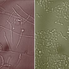 Microscopic view of Candida albicans