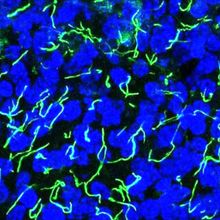Squiggly green cilia on blue human beta cells 