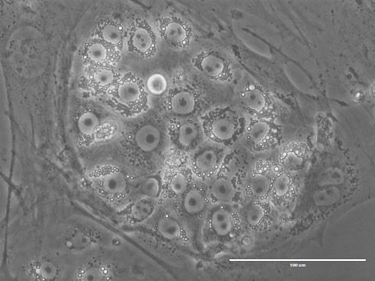 A greyscale microscopy image of a cluster of cells. A greyscale microscopy image of a cluster of cells.