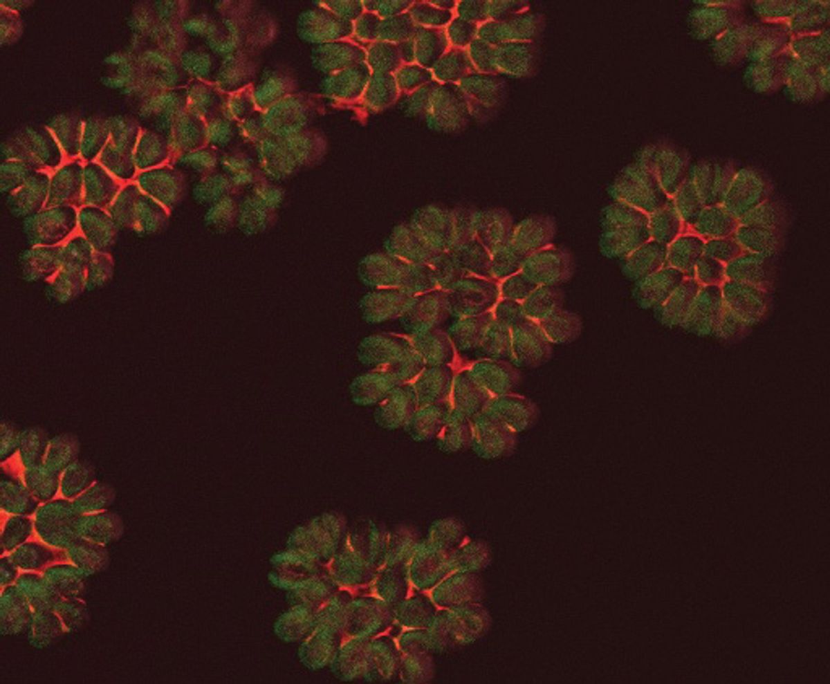 a microscopy image of Botryococcus braunii in green and red. a microscopy image of Botryococcus braunii in green and red.