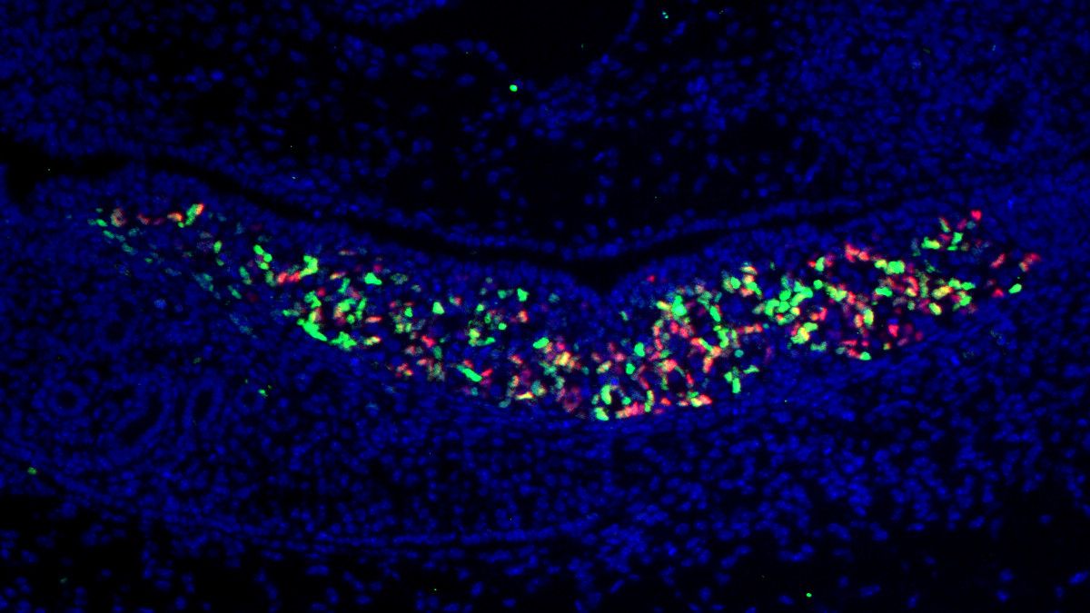 A microscopy image showing a cluster of red and green cells in a strip surrounded by blue cells. A microscopy image showing a cluster of red and green cells in a strip surrounded by blue cells.