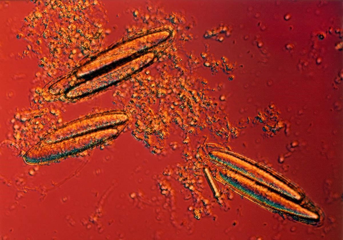 Three dividing <em >Epulopiscium viviparus</em> cells seen on a microscope. Three dividing <em >Epulopiscium viviparus</em> cells seen on a microscope.